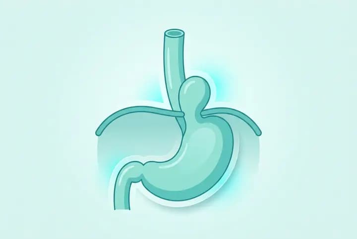 Hiatus Hernia