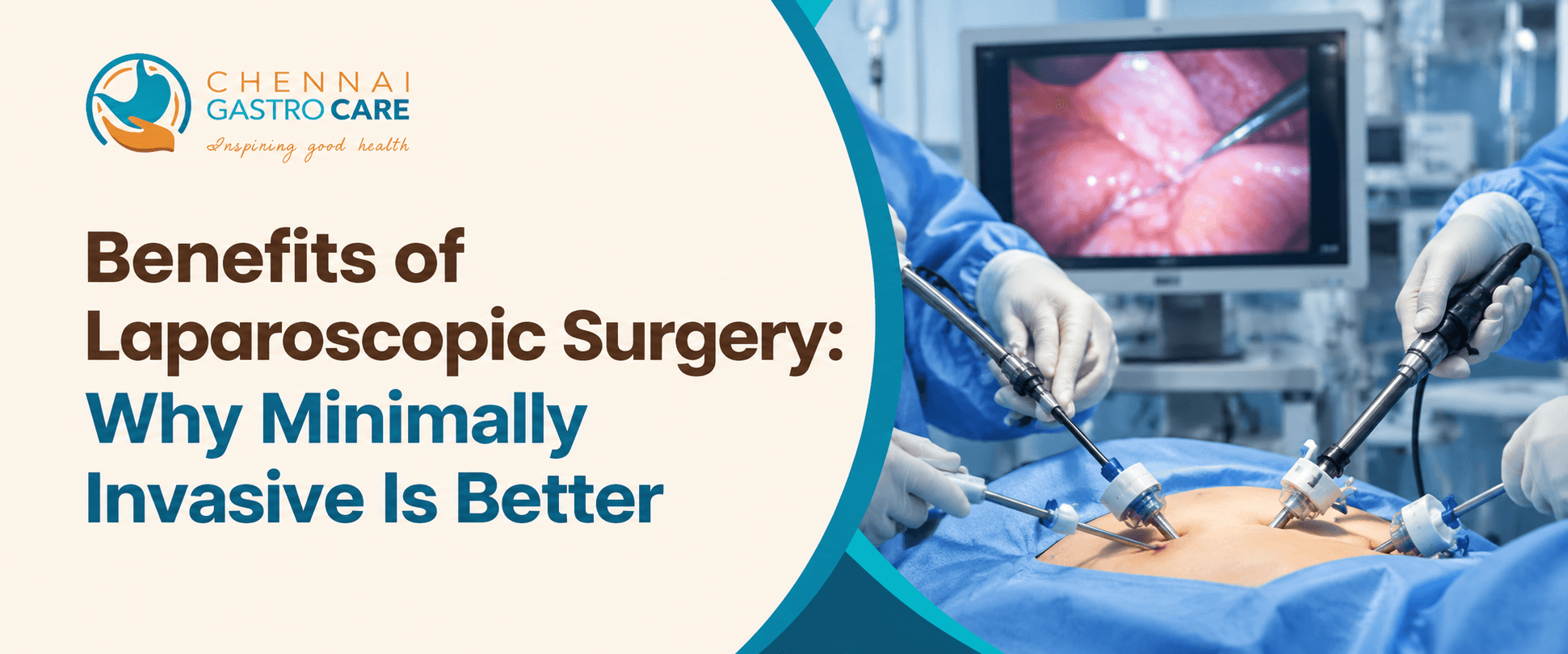 Benefits of Laparoscopic Surgery: Minimal Invasiveness Explained