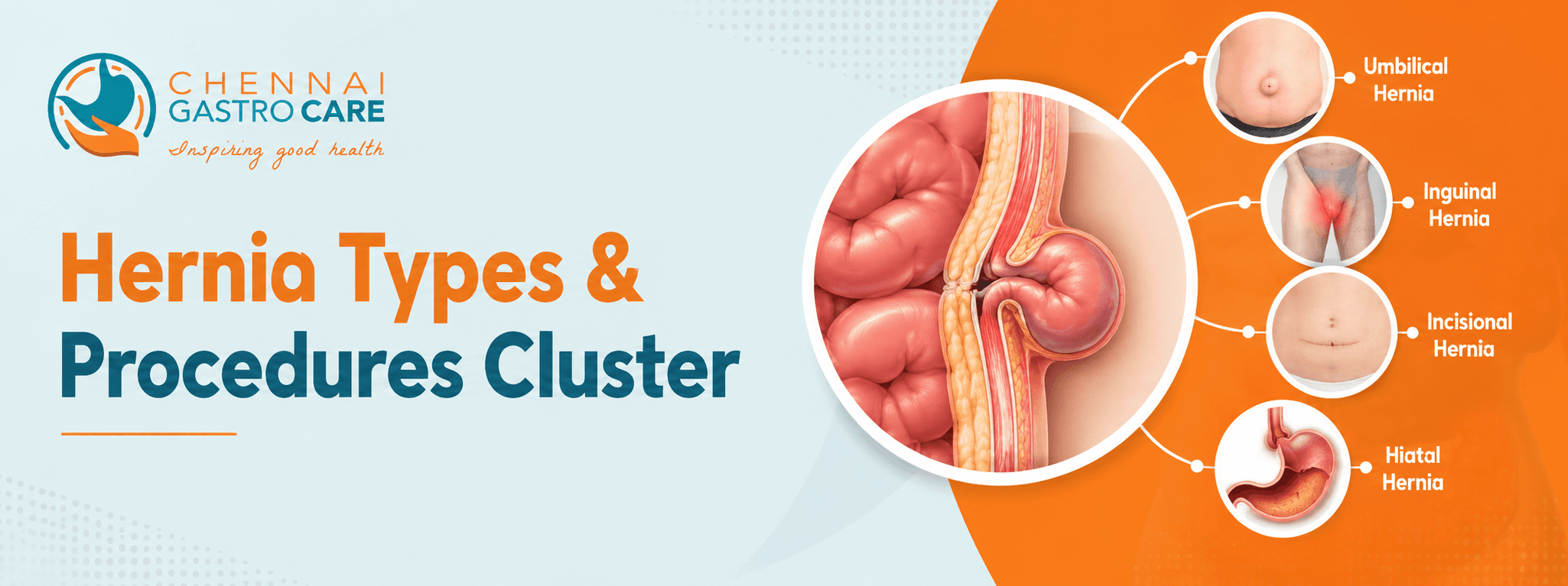 Hernia Types & Procedures Cluster