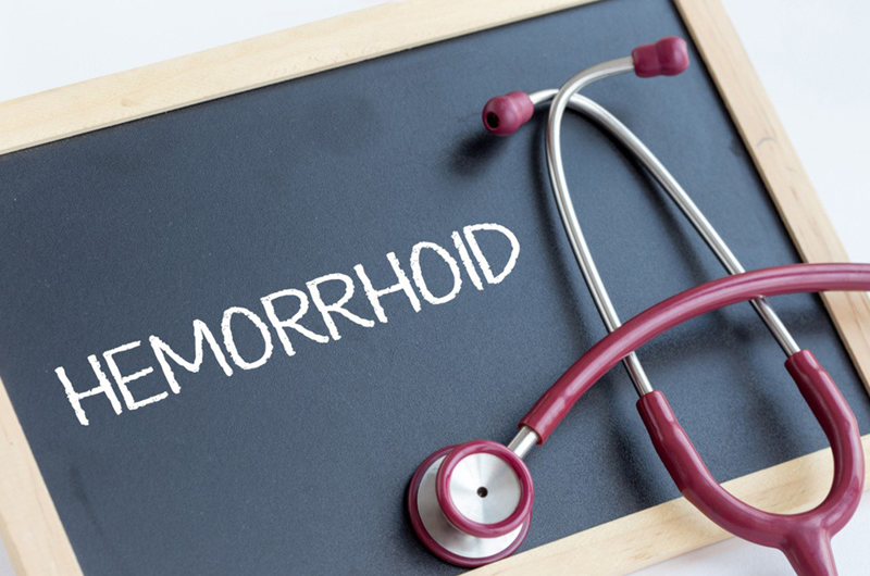 Hemorrhoids-prevention